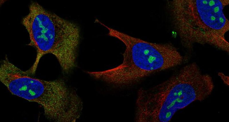 Powstała najbardziej szczegółowa mapa ludzkiej komórki