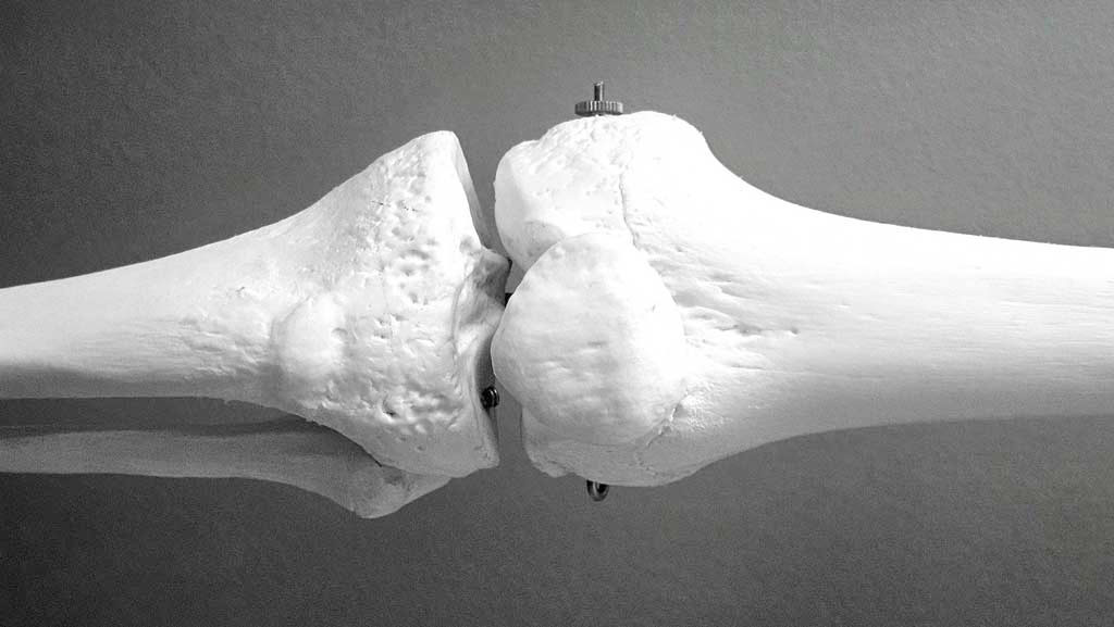 Sprawdź które produkty osłabiają Twoje kości?